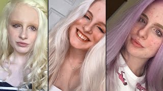 Albino woman becomes online sensation thanks to VIOLETCOLOURED EYES [upl. by Joyan326]