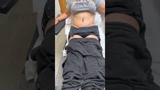 1 WEEK AFTER A TUMMY TUCK BY DR GABRIEL PATINO 09 16 2024 4105257999 [upl. by Ycnahc]