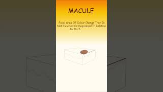 What is Macule Papule and Nodule  Common Oral Pathology Terms  Basic Viva Qs  shorts [upl. by Bruce]