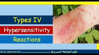 Lecture 7 Type IV Hypersensitivity Reaction [upl. by Francene451]