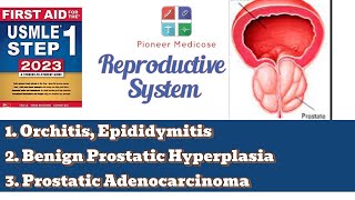 USMLE step 1 Epidimitis orchitis and BPH from First Aid Reproductive system pathUrduHindi [upl. by Gunthar]