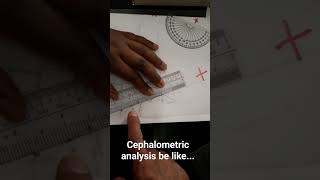 Cephalometric analysis detectivework orthodontics smile subscribe credits comment antropology [upl. by Aivalf47]