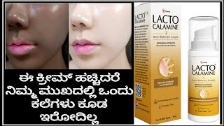 Lacto calamine AntiBlemish Cream Review In KannadaRemove PigmentationDark spots100 Result [upl. by Acila]