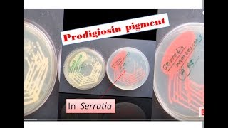 Prodigiosin pigment formation in Sarratia Serratia marcescens Prodigiosin [upl. by Hillegass221]