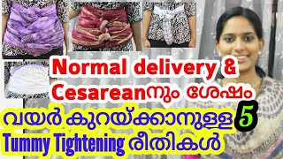 Tummy Tuck Methods to Reduce Belly after Normal Delivery amp Cesarean Pregnancy Lactation Series32 [upl. by Ahsinek]