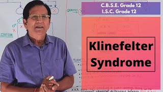 Klinefelter Syndrome  Grade 12 Biology [upl. by Riggall]