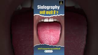 Sialography क्यो करते है radiographer drt shortvideo brtclasses xray Sialography shorts [upl. by Arednaxela]