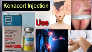 Kenacort 40 mg injection का उपयोग  Triamcinolone acetonide injection दाद खाजखुजलीआर्थराइटिस [upl. by Trish]