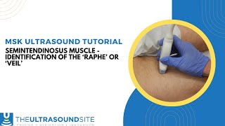 Ultrasound identification of the Semitendinosus muscle Raphe or Veil [upl. by Airamzul]