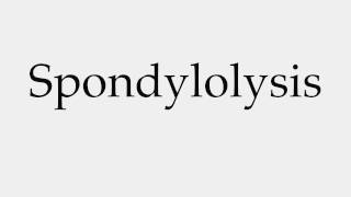 How to Pronounce Spondylolysis [upl. by Mac]