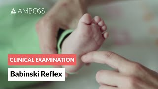 Babinski Reflex in Infants  Clinical Examination [upl. by Tnomad]