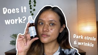 I tried THE ORDINARY CAFFEINE SOLUTION 5  EGCG for 7 weeks on my panda eyes ⎮English [upl. by Yebot]