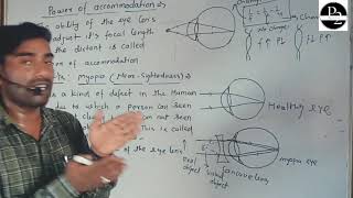 Defects  myopia  hypermetropia  presbyopia  contract  by Rahul Sir [upl. by Attevaj802]