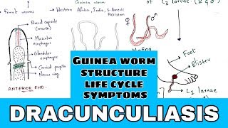 Dracunculiasis  Guinea worm  Structure Life cycle symptoms treatment  Bio science [upl. by Ayhtak]