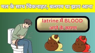 मल के साथ चिकनाहट बलगम या झाग आने के कारण latrine me aav aana blood wali potty aane ke reasons [upl. by Farica]