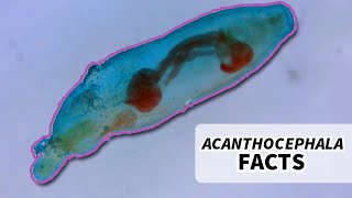 Acanthocephala Facts the Thorny Headed Worm  Animal Fact Files [upl. by Namyac]