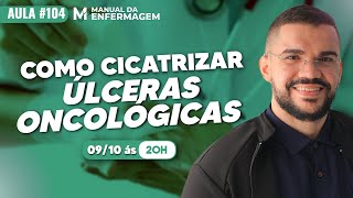 Como CICATRIZAR um ÚLCERA ONCOLOGICA 2x mais rapido  VIDEO AULA 104 [upl. by Maddy353]