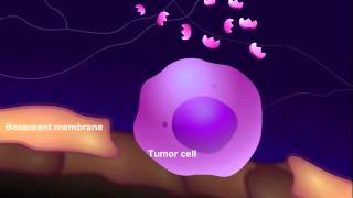 Introduction to Cancer Biology Part 3 Tissue Invasion and Metastasis [upl. by Sible]