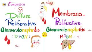 Diffuse Proliferative Glomerulonephritis vs Membranoproliferative Glomerulonephritis  DPGN vs MPGN [upl. by Jerol]