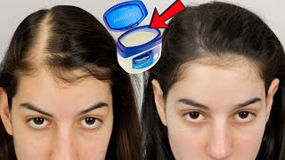 Vaseline Magic for Accelerated Hair Growth [upl. by Durwyn237]