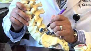 Surgical Procedures  Lumbar Laminectomy amp Discectomy [upl. by Giacopo]