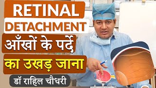 Retinal Detachment  आँख के पर्दे का अपनी जगह से हट जाना  Cause Symptoms Diagnosis and Treatment [upl. by Euqinehs]