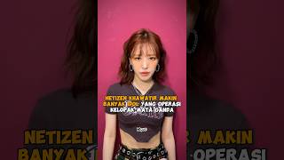 Netizen khawatir makin banyak idol yang operasi kelopak mata ganda wendy redvelevet shorts kpop [upl. by Siderf]