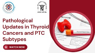 Pathological Updates in Thyroid Cancers and PTC Subtypes [upl. by Eatnoj]