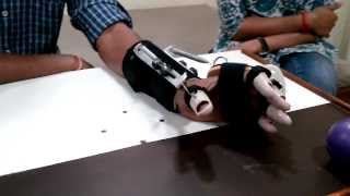 DHS Dynamic Hand Splint spastic hand splint [upl. by Longmire]