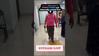 Antalgic gait shorts gaittraining mbbs neet trending [upl. by Nnairda]