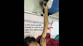 How to insert PICC LINE 📉😱😰in 3mincancercenter cancerpatient cannulation doctor hospital [upl. by Aneen]