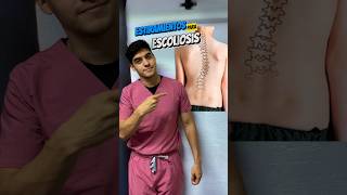 Rutina de estiramientos para escoliosis corrige tu escoliosis fisioterapia ejercicio [upl. by Henrik]