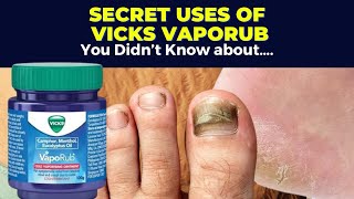 5 Secret Uses of Vicks VapoRub You Didnt Know About [upl. by Yetta36]