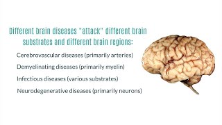 Neurodegenerative Diseases of the Brain [upl. by Anilorac686]