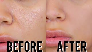 HOW TO MINIMIZE ENLARGED PORES  THE ULTIMATE GUIDE  SKINCARE  MAKEUP TIPS [upl. by Shedd122]