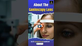 About the gonioscopy lens goniolens glaucoma ophthalmology testpaperlive education [upl. by Alleiram]