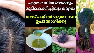 Hair fall amp dandruff treatment at home❤How to reduce scalp itching❤Best forehead hair loss remedy [upl. by Thorsten841]