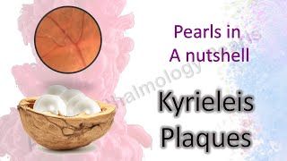 Kyrieleis Plaques │ Pearls in A Nutshell 7 [upl. by Walter823]