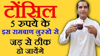 टॉन्सिल का घरेलू उपचार tonsil ka ilaj  How To Cure Tonsils  tonsil kaise thik kare [upl. by Nilved867]