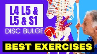 L4 L5 amp L5 S1 Disc Bulge Best Exercises Rehab For Relief [upl. by Langille83]