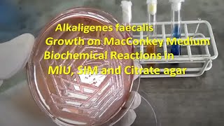 Alkaligenes faecalis Colony Morphology on Macconkey agar and Biochemical Reactions Demonstration [upl. by Yonah932]