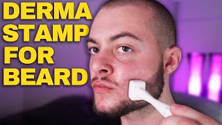 How To Derma Stamp Beard Properly Derma Stamp Tutorial Minoxidil amp Derma Stamp [upl. by Assile]