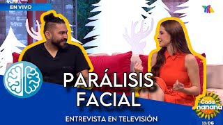 ¿Cómo saber si tengo una Parálisis Facial Entrevista en TV paralisisfacial fisioterapia tvazteca [upl. by Wearing]