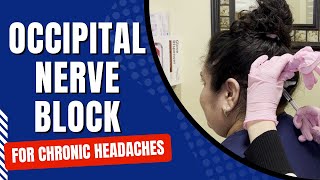 Occipital Nerve Block for Chronic Headaches [upl. by Earesed921]