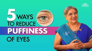 Home Remedies for Puffy Eyes I Treat puffy eyes naturally I Dr Hansaji [upl. by Nauh]