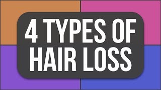 What type of hair loss are YOU experiencing [upl. by Eanal]