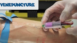 Venipuncture  How to take Blood  OSCE Guide old version  UKMLA  CPSA [upl. by Madson]