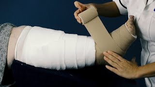 Clinistretch Multi Layer Compression Bandaging for Lower Limb [upl. by Presley]