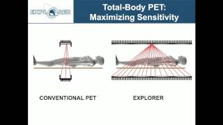 Simon Cherry EXPLORER  Changing the Molecular Imaging Paradigm with TotalBody PETCT [upl. by Siegfried]