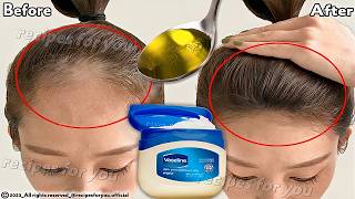 How to use Vaseline for double hair growth your hair will grow 3 times faster hair growth tips🪮 [upl. by Rodl]